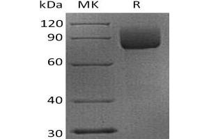 Western Blotting (WB) image for CD19 Molecule (CD19) protein (Fc Tag) (ABIN7321005) (CD19 Protein (Fc Tag))