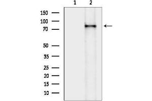 Western blot analysis of lysates from K562 cells(heat-shock treatment), using Phospho-AK (Ser474) Antibody.