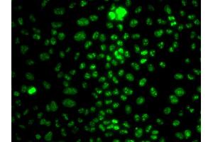 Immunofluorescence analysis of HeLa cells using MKI67 antibody (ABIN5998234). (Ki-67 Antikörper)