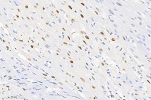 Immunohistochemistry analysis of paraffin-embedded rat heart using,SET (ABIN7075583) at dilution of 1: 10000 (SET/TAF-I Antikörper)