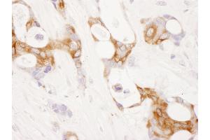 Immunohistochemistry (IHC) image for anti-Prostaglandin-Endoperoxide Synthase 2 (Prostaglandin G/H Synthase and Cyclooxygenase) (PTGS2) (AA 554-604) antibody (ABIN7454933)