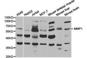Western Blotting (WB) image for anti-Matrix Metallopeptidase 1 (Interstitial Collagenase) (MMP1) antibody (ABIN1873712) (MMP1 Antikörper)