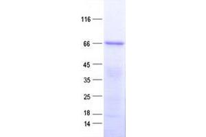 Validation with Western Blot (ZNF572 Protein (His tag))