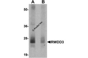 Western Blotting (WB) image for anti-RWD Domain Containing 3 (RWDD3) (N-Term) antibody (ABIN1031549)
