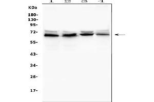 Western blot analysis of IFNAR2 using anti-IFNAR2 antibody (ABIN7601353).