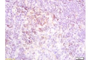 Formalin-fixed and paraffin embedded mouse spleen labeled with Rabbit Anti-TSHR Polyclonal Antibody (ABIN668901) at 1:200 followed by conjugation to the secondary antibody and DAB staining (TSH receptor Antikörper  (AA 501-600))