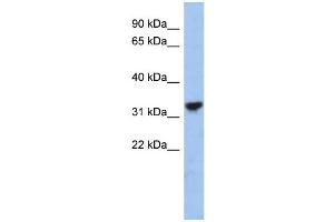 WB Suggested Anti-CYC1 Antibody Titration: 0. (Cytochrome C1 Antikörper  (Middle Region))
