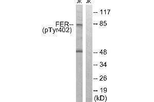 Immunohistochemistry analysis of paraffin-embedded human brain tissue using FER (Phospho-Tyr402) antibody. (FER Antikörper  (pTyr402))