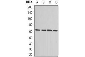 Western blot analysis of MSMB expression in HepG2 (A), Jurkat (B), MCF7 (C), mouse liver (D) whole cell lysates. (MSMB Antikörper)