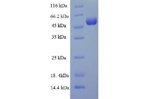 SDS-PAGE (SDS) image for tyrosylprotein Sulfotransferase 2 (TPST2) (AA 26-377) protein (His-SUMO Tag) (ABIN5710542) (TPST2 Protein (AA 26-377) (His-SUMO Tag))