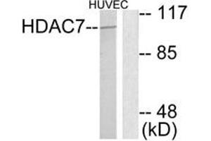 Western Blotting (WB) image for anti-Histone Deacetylase 7 (HDAC7) (AA 901-950) antibody (ABIN2889211) (HDAC7 Antikörper  (AA 901-950))