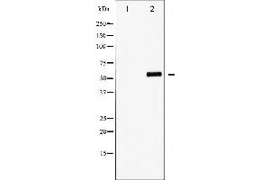 Western blot analysis of FOXO4 phosphorylation expression in EGF treated HuvEc whole cell lysates,The lane on the left is treated with the antigen-specific peptide.