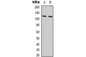 Western blot analysis of RPS6KC1 expression in Hela (A), HEK293T (B) whole cell lysates. (RPS6KC1 Antikörper)