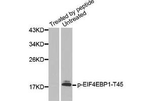Western blot analysis of extracts from Hela cells using Phospho-EIF4EBP1-T45 antibody. (eIF4EBP1 Antikörper  (pThr45))