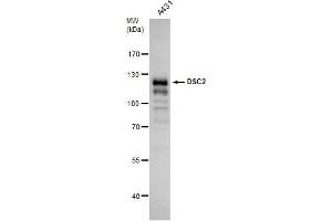 WB Image Desmocollin 2 antibody [C1C2], Internal detects Desmocollin 2 protein by western blot analysis. (Desmocollin 2 Antikörper)