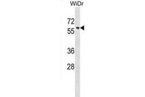 Western Blotting (WB) image for anti-Sorting Nexin 18 (SNX18) antibody (ABIN2999384) (SNX18 Antikörper)