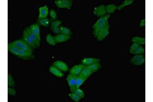 Immunofluorescent analysis of HepG2 cells using ABIN7152720 at dilution of 1:100 and Alexa Fluor 488-congugated AffiniPure Goat Anti-Rabbit IgG(H+L) (FTL Antikörper  (AA 2-175))