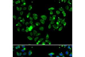 Immunofluorescence analysis of A549 cells using CARD11 Polyclonal Antibody (CARD11 Antikörper)