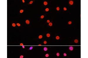 Immunofluorescence analysis of C6 cells using DiMethyl-DNMT3A-K44 Polyclonal Antibody at dilution of 1:100. (DNMT3A Antikörper  (2meLys44))