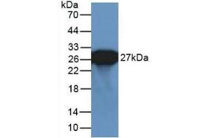 Detection of Recombinant GFP using Polyclonal Antibody to Green Fluorescent Protein (GFP) (GFP Antikörper  (AA 1-238))