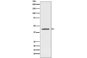 Western blot analysis of HMBS expression in HepG2 cell lysate.