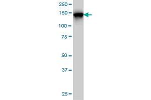 TMEM1 monoclonal antibody (M01), clone 5B4 Western Blot analysis of TMEM1 expression in Hela S3 NE .