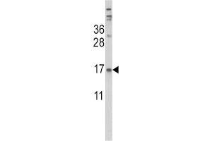 Western Blotting (WB) image for anti-Transthyretin (TTR) antibody (ABIN3002756)