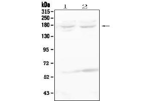 Western blot analysis of RET using anti-RET antibody (ABIN6719502).