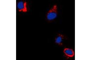 Immunofluorescent analysis of EPHB1/2 (pY594/604) staining in A431 cells. (EPHB1/2 Antikörper  (pTyr594, pTyr604))