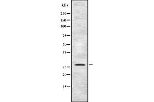 Western blot analysis of FGFP1 expression in HEK293 cells ,The lane on the left is treated with the antigen-specific peptide. (FGFBP1 Antikörper  (C-Term))