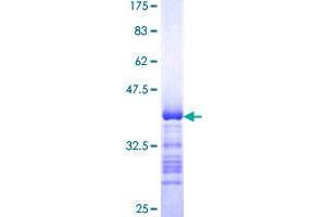 Image no. 1 for Tyrosine-Protein Phosphatase Non-Receptor Type 4 (PTPN4) (AA 361-460) protein (GST tag) (ABIN1316845) (PTPN4 Protein (AA 361-460) (GST tag))