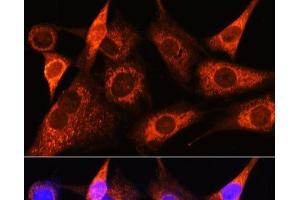 Immunofluorescence analysis of NIH-3T3 cells using PSAT1 Polyclonal Antibody at dilution of 1:100 (40x lens). (PSAT1 Antikörper)