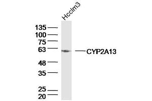 Image no. 1 for anti-Cytochrome P450, Family 2, Subfamily A, Polypeptide 13 (CYP2A13) (AA 301-400) antibody (ABIN5675274)