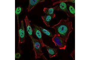 Immunofluorescence analysis of Hela cells using NBN mouse mAb (green). (Nibrin Antikörper  (AA 467-615))