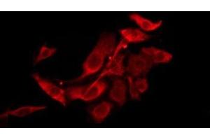 ABIN6276223 staining HepG2 by IF/ICC. (TAS2R39 Antikörper  (Internal Region))