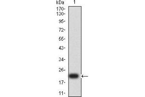 Western blot analysis using SP17 mAb against human SP17 (AA: 1-152) recombinant protein. (SPA17 Antikörper  (AA 1-152))
