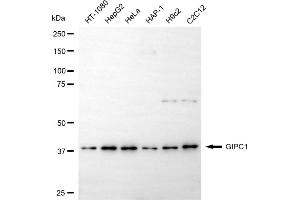 anti-GIPC PDZ Domain Containing Family, Member 1 (GIPC1) antibody