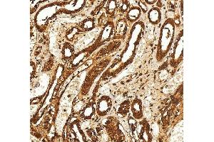 IHC analysis of SELENBP1 using anti-SELENBP1 antibody (ABIN7600755). (SELENBP1 Antikörper  (AA 23-462))