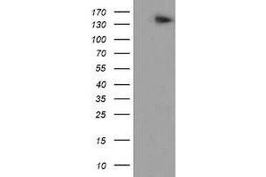 Western Blotting (WB) image for anti-ATP/GTP Binding Protein 1 (AGTPBP1) (AA 368-753) antibody (ABIN1491459)