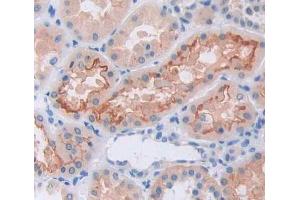 Used in DAB staining on fromalin fixed paraffin- embedded Kidney tissue (GRIK2 Antikörper  (AA 286-561))