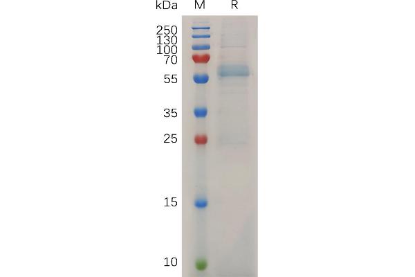 MMP13 Protein (AA 20-148) (His tag)