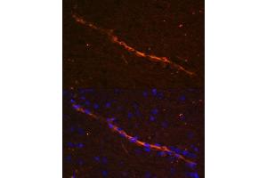 Immunofluorescence analysis of rat brain using CD34 antibody (ABIN6134661, ABIN6138169, ABIN6138171 and ABIN6218103) at dilution of 1:100. (CD34 Antikörper  (C-Term))