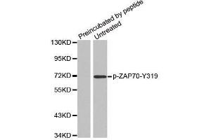 Western blot analysis of extracts from Jurkat cells, using phospho-ZAP70-Y319 antibody.