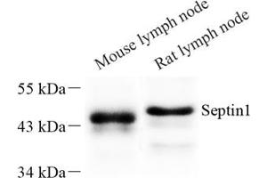 Western blot analysis of Septin1 (ABIN7074453) at dilution of 1: 500 (LARP1 Antikörper)