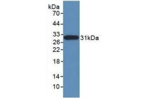 Detection of Recombinant NES, Human using Monoclonal Antibody to Nestin (NES) (Nestin Antikörper  (AA 178-399))