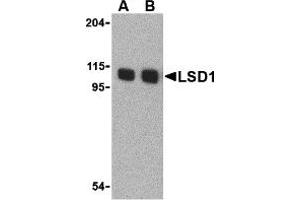 Western Blotting (WB) image for anti-Lysine (K)-Specific Demethylase 1A (KDM1A) (N-Term) antibody (ABIN1031442) (LSD1 Antikörper  (N-Term))
