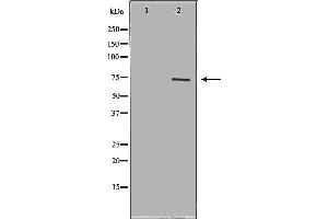Western blot analysis of extracts of Sw626 ,using FSHR antibody. (FSHR Antikörper  (Internal Region))