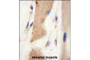 Formalin-fixed and paraffin-embedded human skeletal muscle tissue reacted with CDH15 polyclonal antibody  , which was peroxidase-conjugated to the secondary antibody, followed by DAB staining. (CDH15 Antikörper  (C-Term))