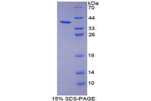 SDS-PAGE (SDS) image for Trophoblast Glycoprotein (TPBG) (AA 32-351) protein (His tag) (ABIN2127089)