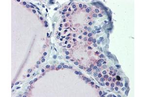 Immunohistochemistry (IHC) image for anti-GNAS Complex Locus (GNAS) (N-Term) antibody (ABIN2775542)